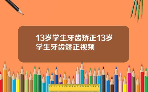 13岁学生牙齿矫正13岁学生牙齿矫正视频